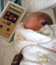 میزان شنوایی نوزاد و زمان تشخیص کم شنوایی 