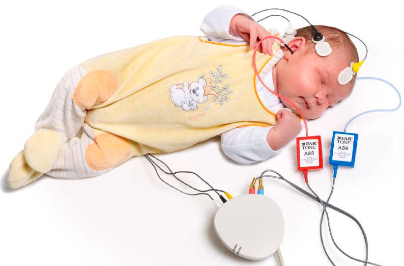 ارزیابی شنوایی نوزادان