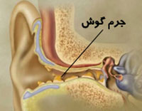 جرم گوش