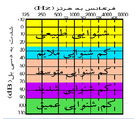 ادیومتری 