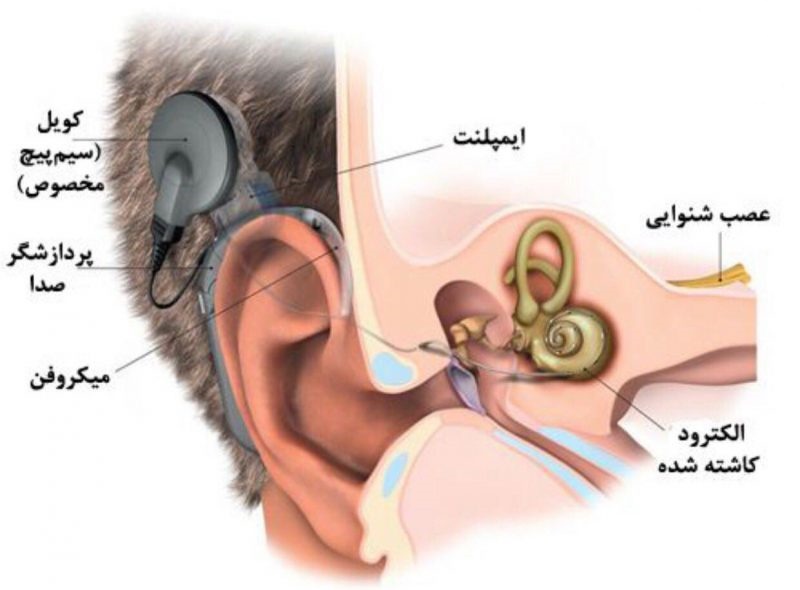 ساختار حلزون شنوایی