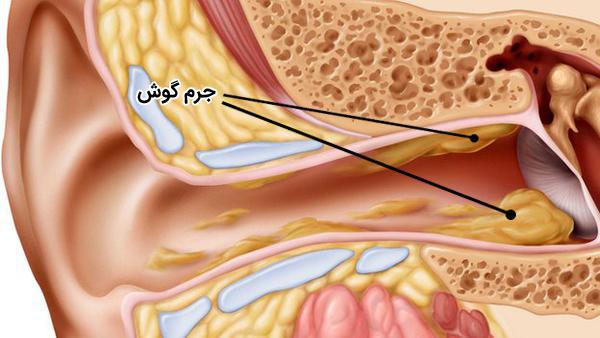 جرم گوش